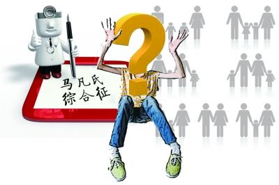 馬凡氏綜合征