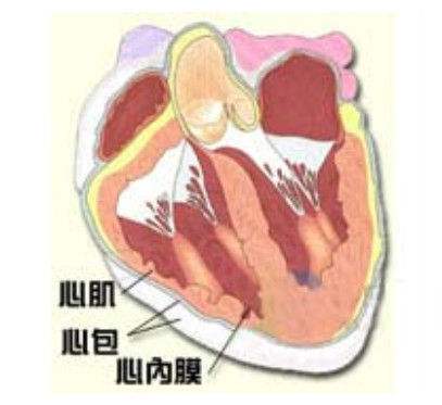 心包囊腫