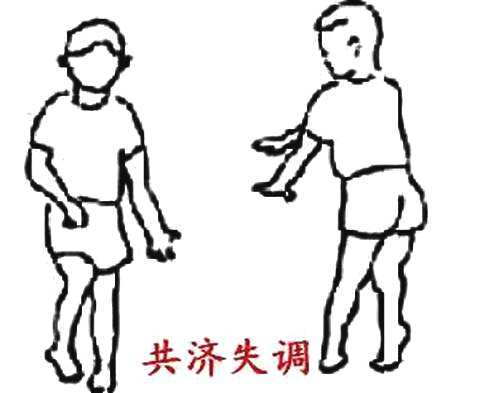 共濟失調