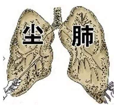 塵肺