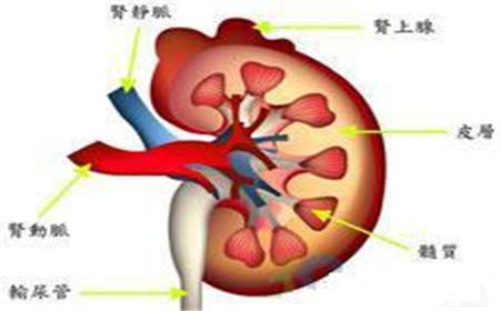 腎盂腎炎