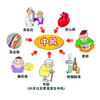 腦中風(fēng)