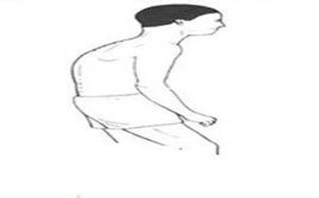 先天性肌強(qiáng)直