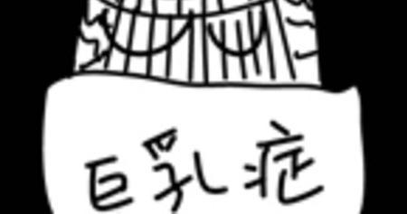 巨乳癥