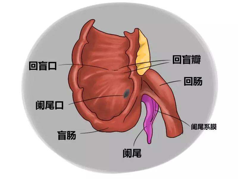 急性闌尾炎