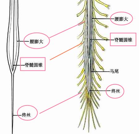 馬尾神經綜合癥