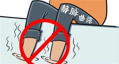 單純性下肢靜脈曲張