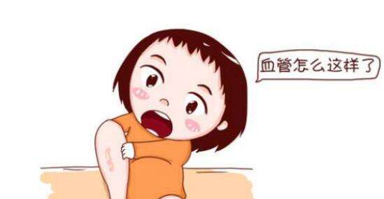 原發(fā)性下肢深靜脈瓣膜關閉不全