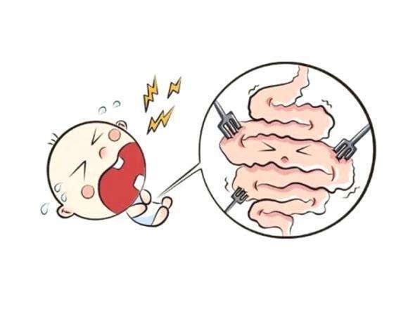 腸痙攣