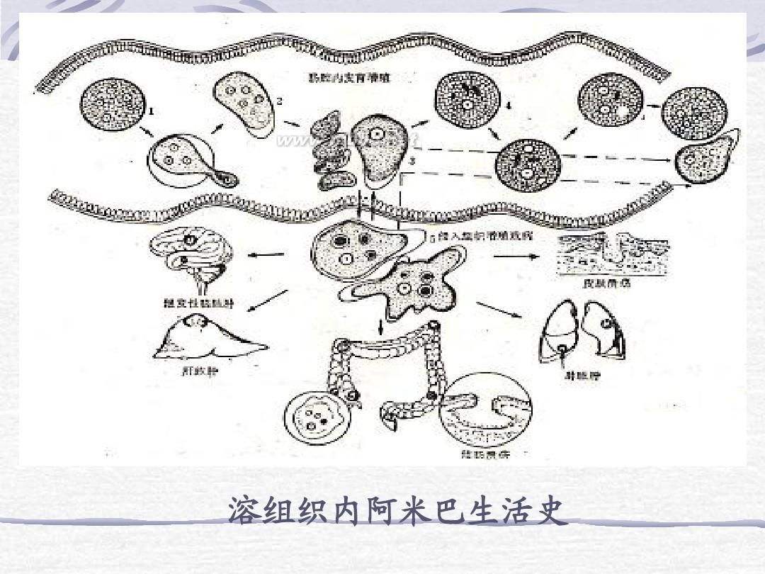 腸阿米巴病