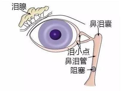 淚腺囊樣腺癌