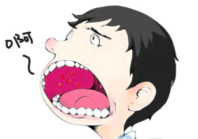 牙齦瘤