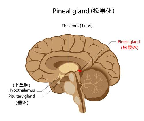 松果體區瘤