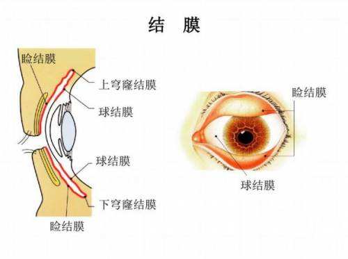 結膜炎