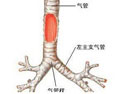 氣管腫瘤