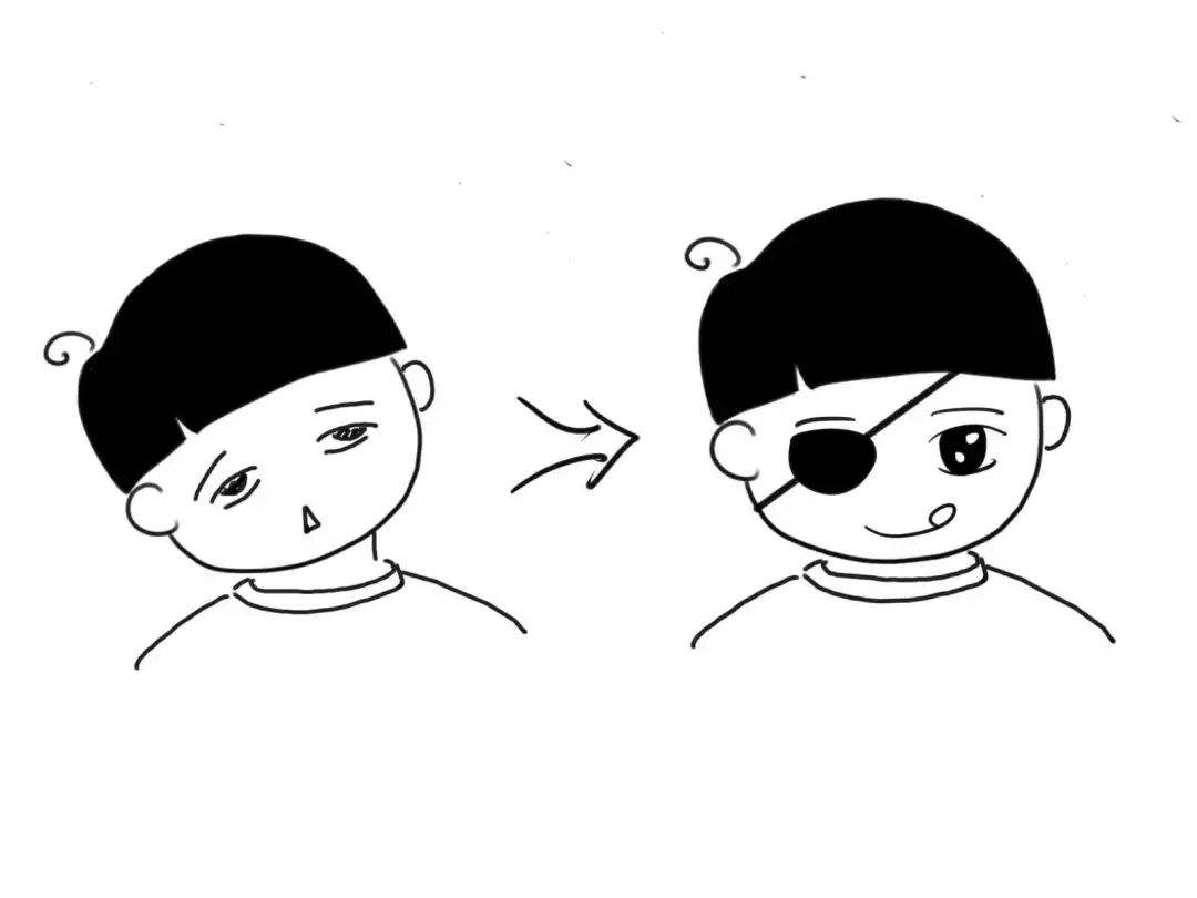 屈光參差