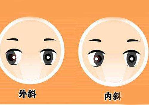 斜視