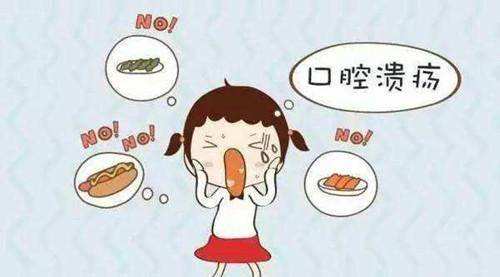 口腔潰瘍
