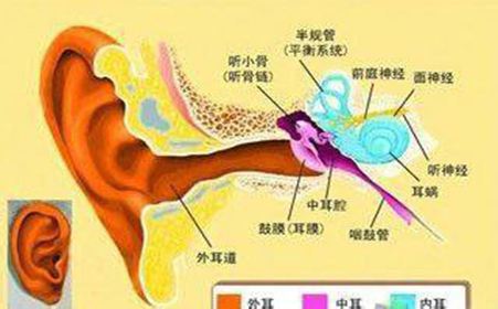 膽脂瘤型中耳炎