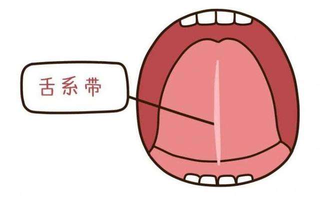 舌系帶過短