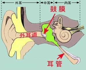 大皰性鼓膜炎