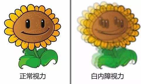 白內障