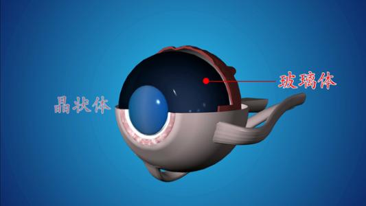 外傷性白內(nèi)障