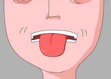 地圖舌