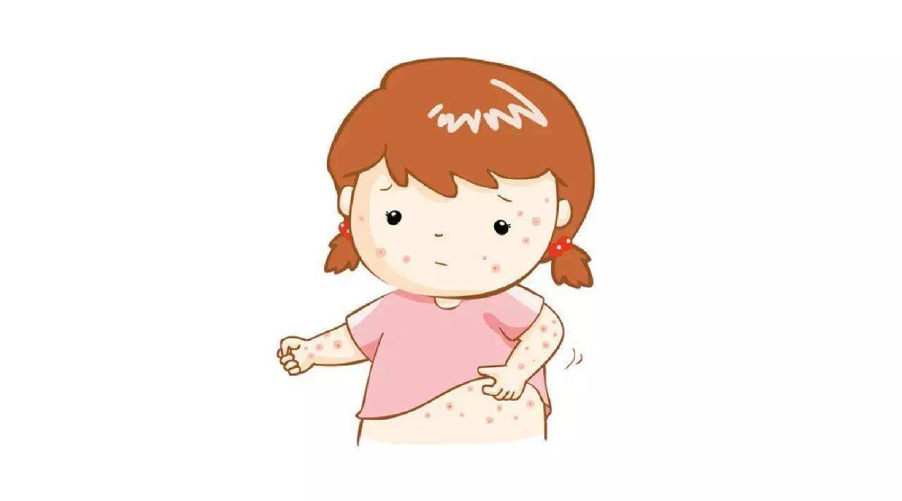 濕疹