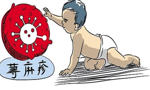 蕁麻疹