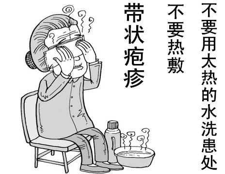 帶狀皰疹