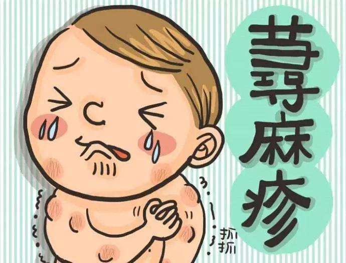 丘疹性蕁麻疹