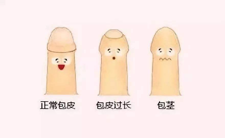 包皮過長