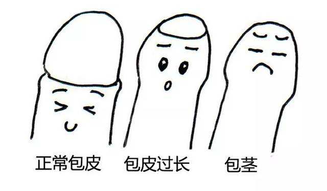 包莖