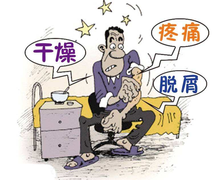 銀屑病