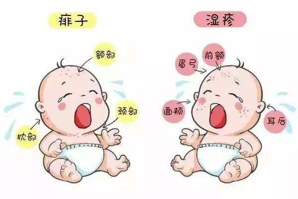 小兒濕疹
