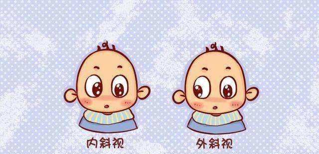 小兒斜視