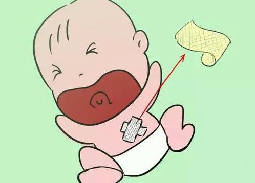 新生兒臍部疾病
