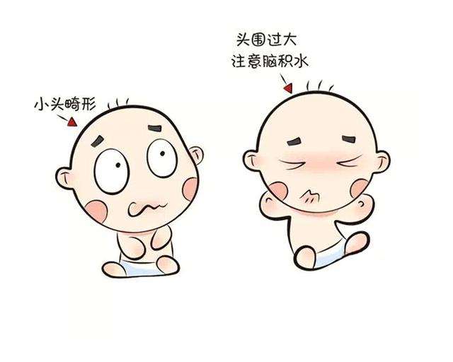 小頭畸形