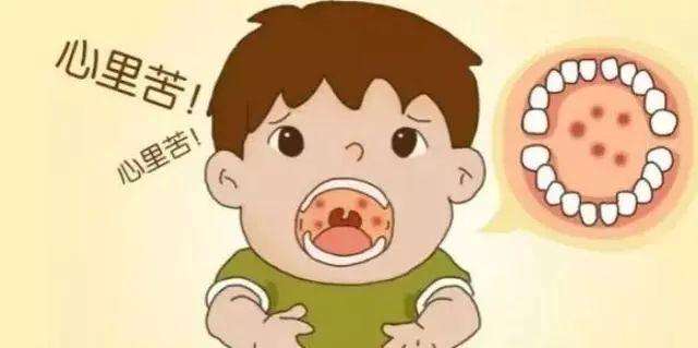 小兒皰疹性咽峽炎