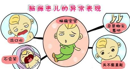 小兒腦癱