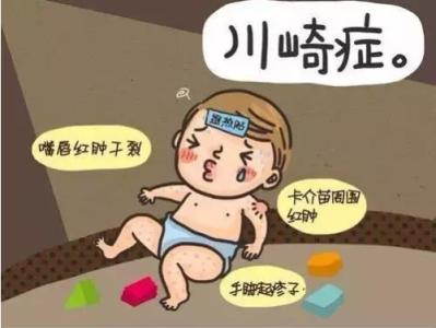 川崎病