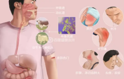 布病